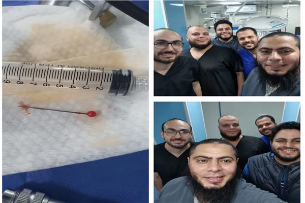 فريق جراحي بمستشفى كفر الشيخ العام