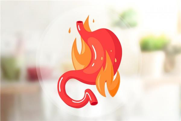  ارتجاع المريء والصيام