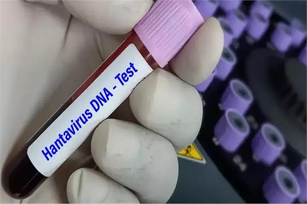بعد قتله لزوجة جين هاكمان وتسببه في وفيات في كاليفورنيا.. ما هو فيروس هانتا؟