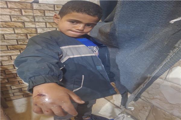 أحد المصابين من عقر الكلاب