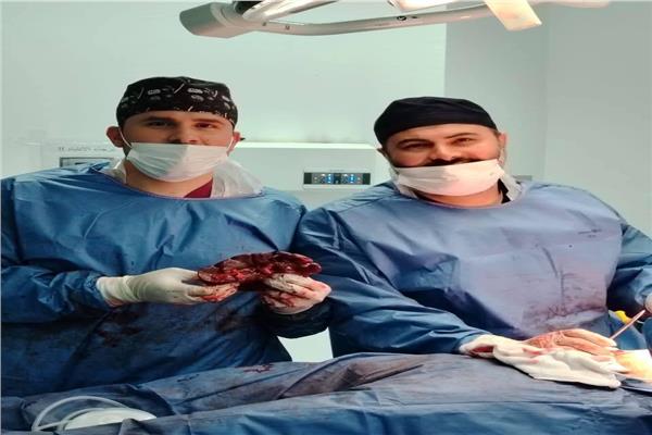 ريق طبي متخصص في مستشفى بئر العبد النموذجي خلال عملية استئصال الطحال