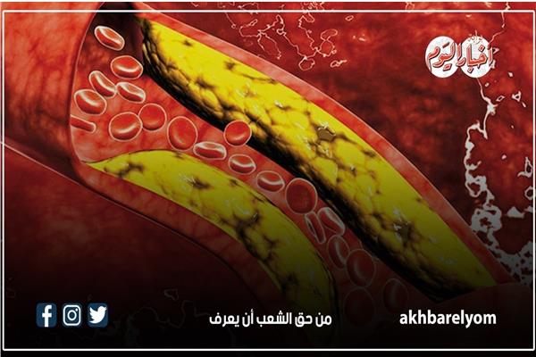 صورة موضوعية