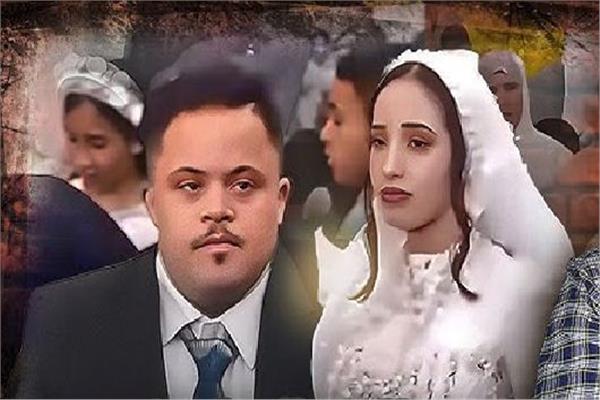 عريس متلازمة داون وعروسه