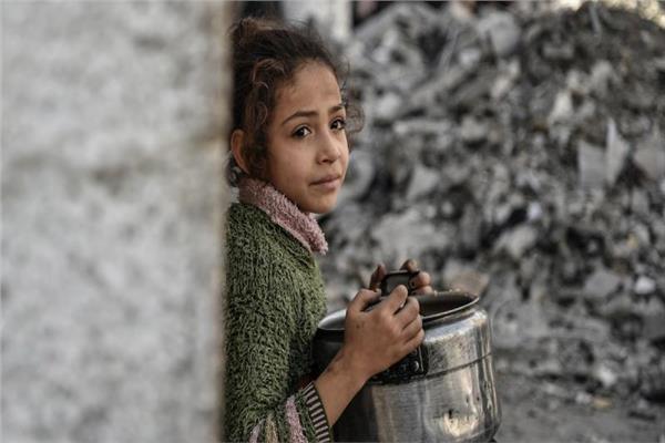 وفاة طفلة نتيجة سوء التغذية