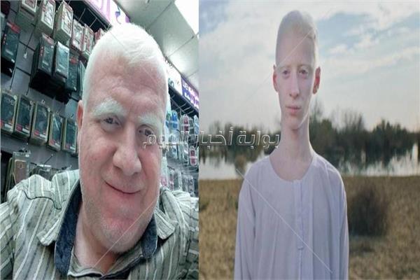  بدر محمد بطل فيلم ضي و أحمد سعد مؤسس أول صفحة للألبينو في مصر