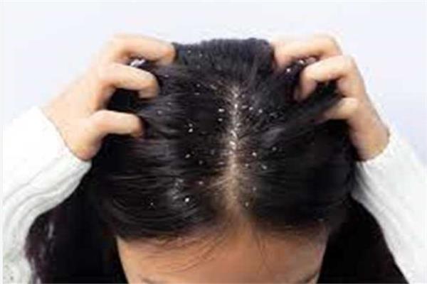صحة فروة الرأس
