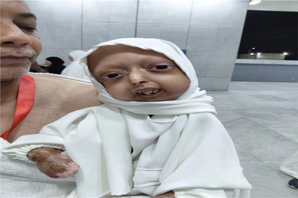 فتاة الشيخوخة المبكرة بقنا