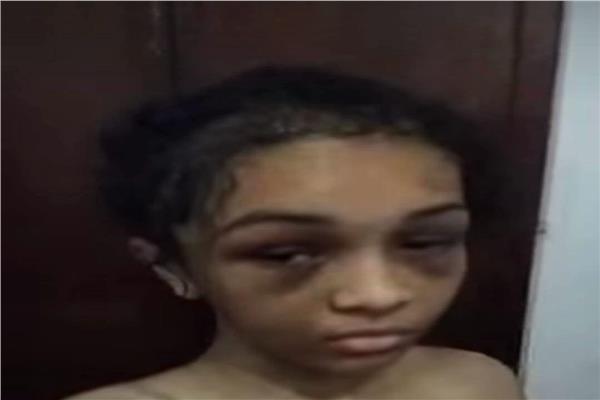 تعذيب  طفلة في كفر الشيخ