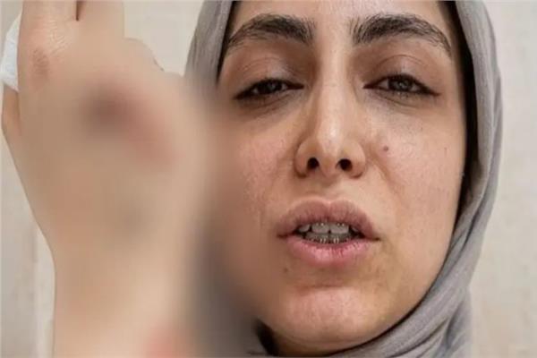 إصابة طبيبة بكسر خطير