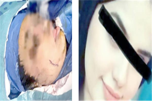 الضحية