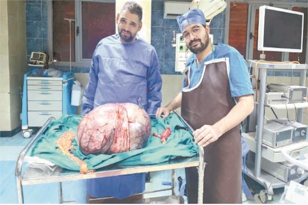 استئصال ورم عملاق