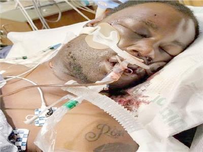 كابوس يناير يطارد الأمريكيين.. من فوضى اقتحام الكونجرس إلى حادث ممفيس العنصرى