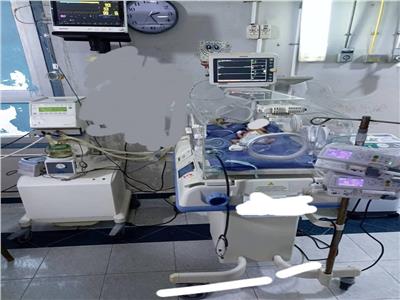 إنقاذ حياة طفلين حديثي الولادة في مستشفى كفر البطيخ المركزي بدمياط