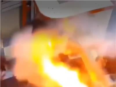 بطارية هاتف تنفجر داخل فم طفل وتصيبه بجروح.. ماذا حدث؟ | فيديو