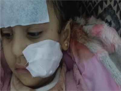فسحة تتحول لمأساة.. القصة الكاملة لهجوم «شبل» على طفلة في السيرك