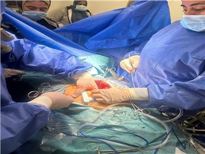 لأول مرة.. نجاح جراحة قلب مفتوح متطورة بمستشفيات جامعة بنها