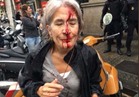صور|سحل وضرب في مظاهرات كتالونيا .. ومغردون: أين حقوق الإنسان؟ 