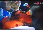 جراحة عاجلة لحارس الإسماعيلي بعد إصابته في مباراة المصري