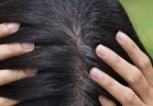 5  وصفات طبيعية للتخلص من الشعر الأبيض 