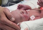 فيديو| ولادة أول طفل بعد عملية زرع رحم في الولايات المتحدة