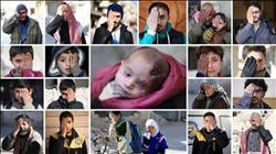تضامن عالمي مع «كريم» ضحية الإرهاب في سوريا |صور