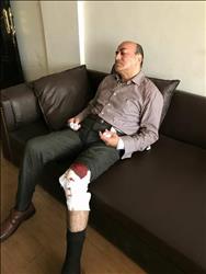 الصور الأولى للمستشار جنينه عقب إصابته في مشاجرة