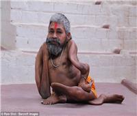 صور| كاهن هندي يكافح مرض نادر..ويقدسه المتدينون 
