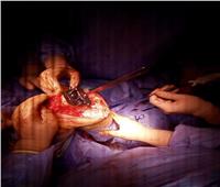 صور| «الزقازيق العام» تجري ثالث جراحة ناجحة لتركيب مفصل ركبة كامل