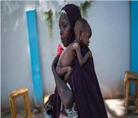 «شعوب جائعة».. 4 دول يعاني سكانها من المجاعة وواحدة على الطريق
