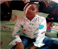 «ملك» طفلة فقدت عينها بمدرسة في الإسماعيلية وعجز الأطباء عن علاجها