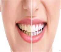 تدخين السجائر والإفراط في معجون الأسنان يسببان تغيير لون الأسنان 