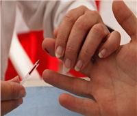 أطباء بريطانيون ينجحون في علاج ثاني مصاب بـ«الإيدز»