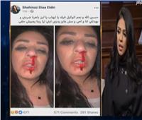 فيديو| الفنانة شاهيناز ضياء تكشف تفاصيل اعتداء زوجها عليها