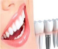 استشاري طب أسنان: التكنولوجيا جعلت طرق عمليات زراعة الأسنان مثيرة