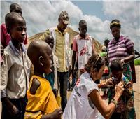 الكونجو تعلن الحصبة وباء بعدما أودت بحياة أشخاص أكثر من الإيبولا