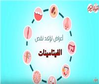 فيديو| تعرف على أعراض نقص الفيتامينات في الجسم