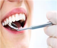  «تسوس» الأسنان أكثر المشاكل انتشارًا في العالم