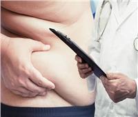«استشاري»: «شفط الدهون» عمليات تجميلية وصحية