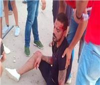 فيديو| شقيق عمرو ذكي يكشف تفاصيل إصابته بالحادث