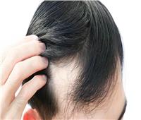 استشاري يكشف أحدث طرق لزراعة الشعر 