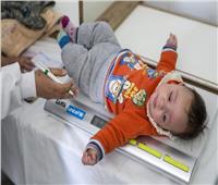 «الصحة» تكشف عن أرصدة ألبان الأطفال وخدمات الأمهات بعد الولادة