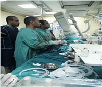 مستشفى قنا الجامعي يساهم في إنقاذ سيدة دون اللجوء لجراحة القلب المفتوح