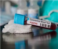 روسيا تختبر 8 عقاقير لعلاج فيروس «كورونا»