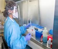 خبراء : نتائج اختبارات "كورونا " تظهر إيجابية للمرة الثانية بسبب بقايا الفيروس "غير الحية"