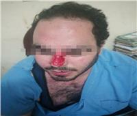 الاعتداء على طبيب بمستشفى طنطا الجامعي