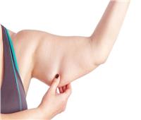 «استشاري جراحات تجميلية» يوضح المناطق التي تستلزم عمليات شد الجلد