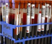 دراسة أمريكية تكشف فصيلة الدم الأكثر مقاومة لـ«كورونا»