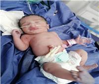 مستشفى قها: نتيجة عينة الطفلة المولودة "مسك" للأم المصابة بكورونا سلبية