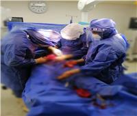 عملية ولادة قيصرية ناجحة لمريضة كورونا بالمستشفى العام بالإسماعيلية