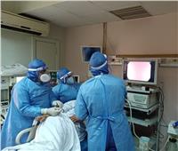 «المستشفيات التعليمية»: تدخلات عاجلة بالمناظير في معهد الكبد لإنقاذ حالتي كورونا